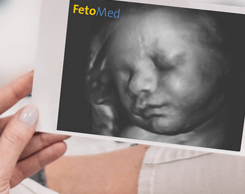Ein 3D-Ultraschallbild eines F&ouml;tus in der Hand einer Frau.